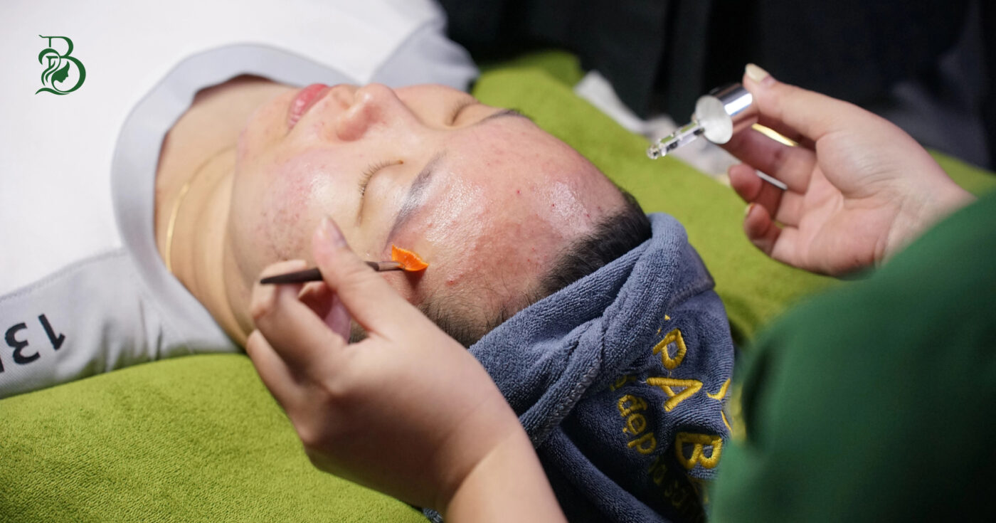 Peel Da Tại Thủ Dầu Một