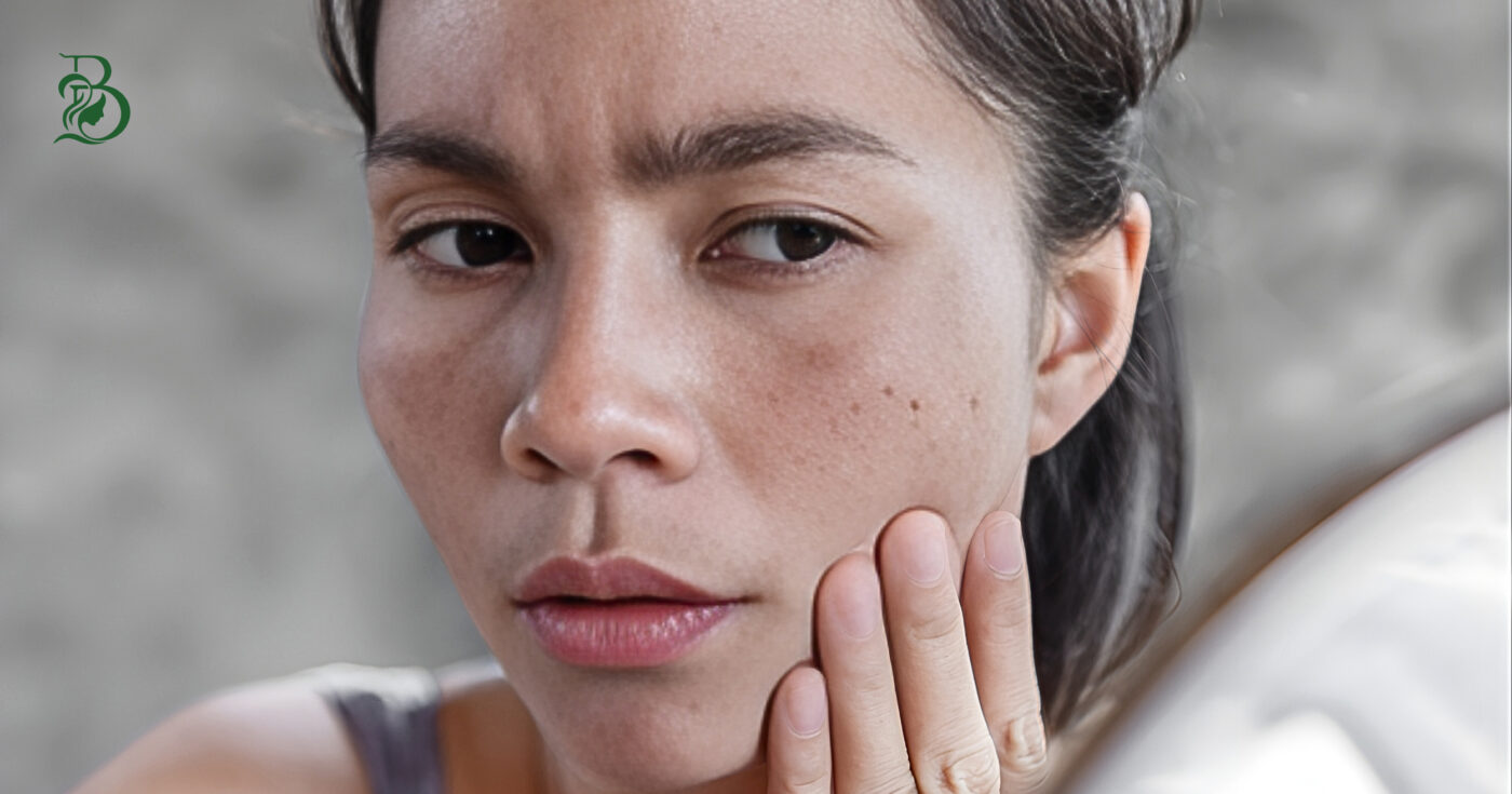 Phục Hồi Da Nhạy Cảm Tại Thủ Dầu Một